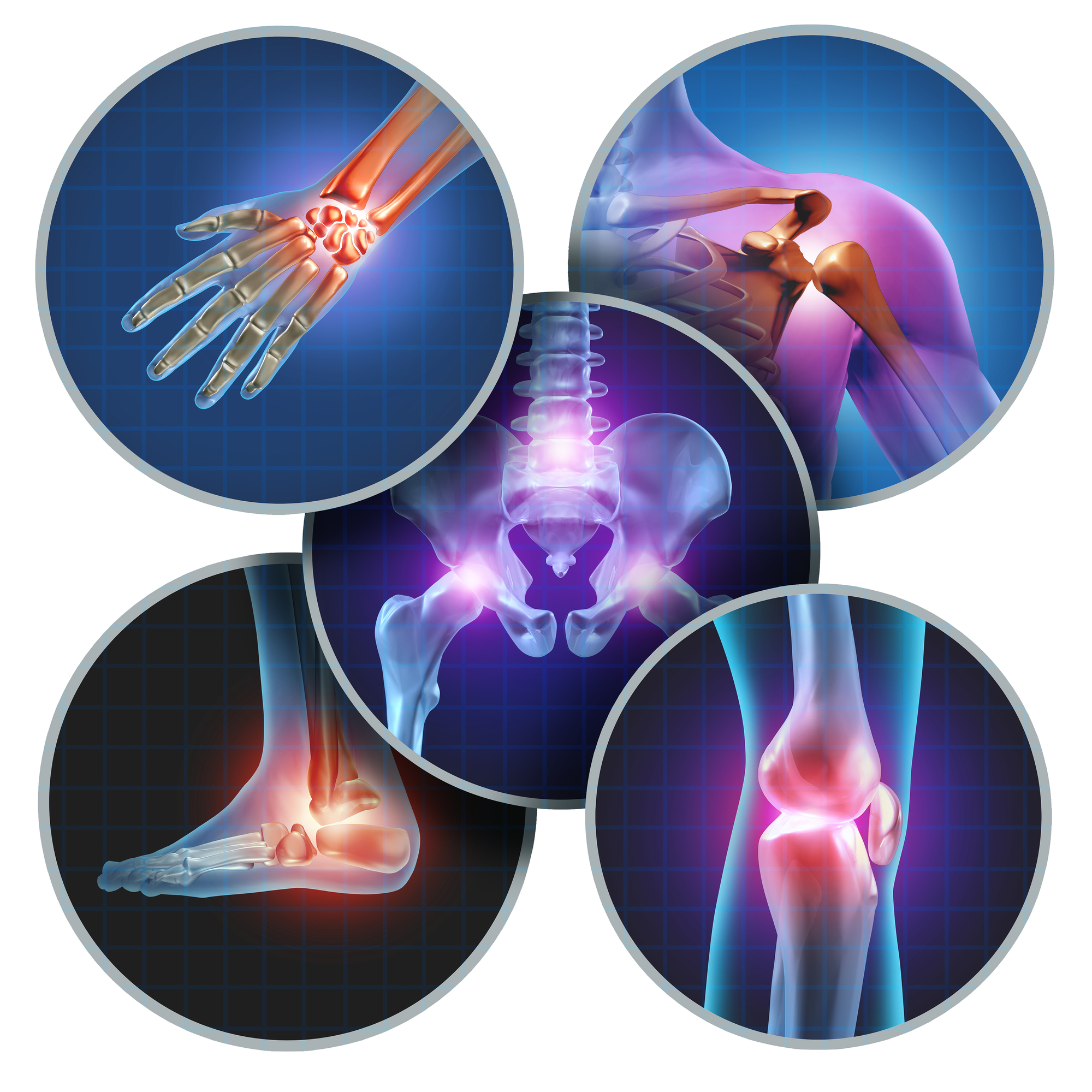 Signs You May Need Physical Therapy - Human Painful Joints